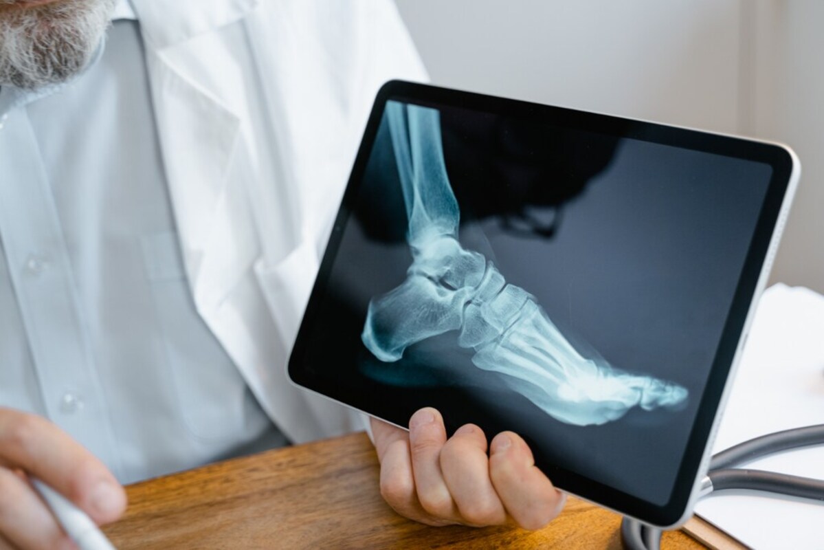 Um médico segura um tablet que mostra um telelaudo de um raio-x de um pé