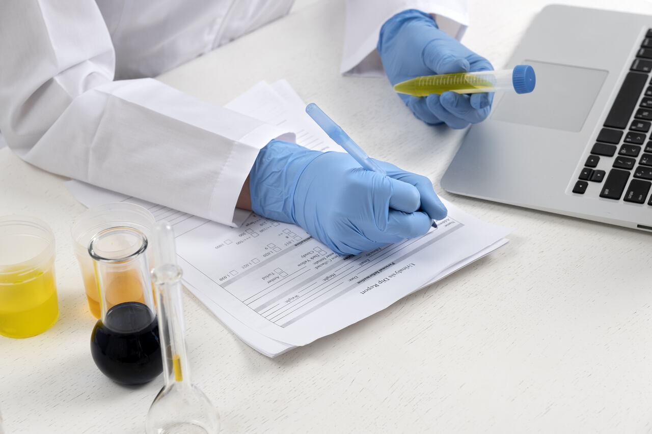 um médico de luva azul preenche um modelo de pedido de exames laboratoriais com uma caneta