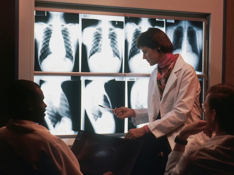 Fotografia de uma médica apontando para o resultado de um exame de raio X, que utiliza medicina nuclear.