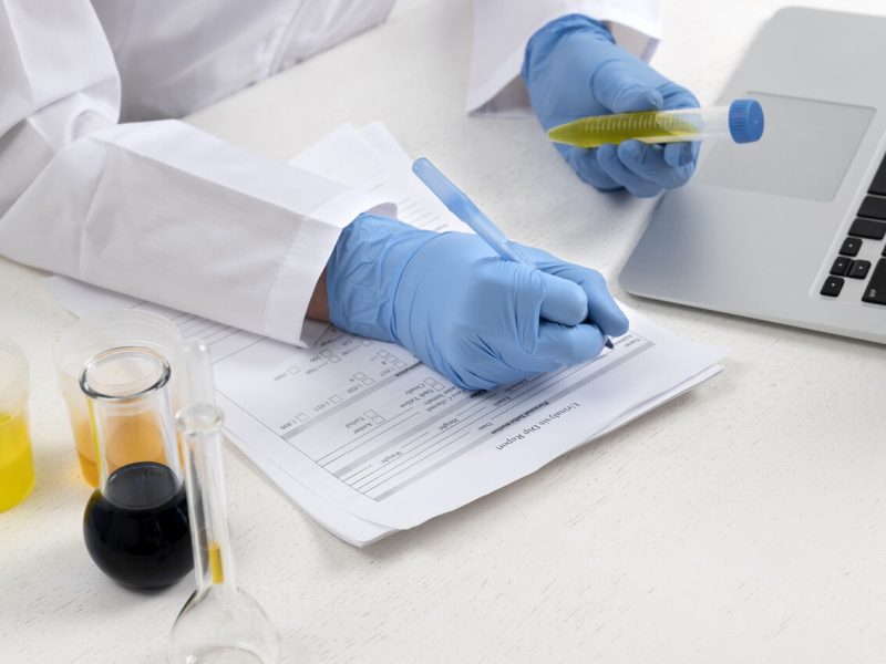 um médico de luva azul preenche um modelo de pedido de exames laboratoriais com uma caneta